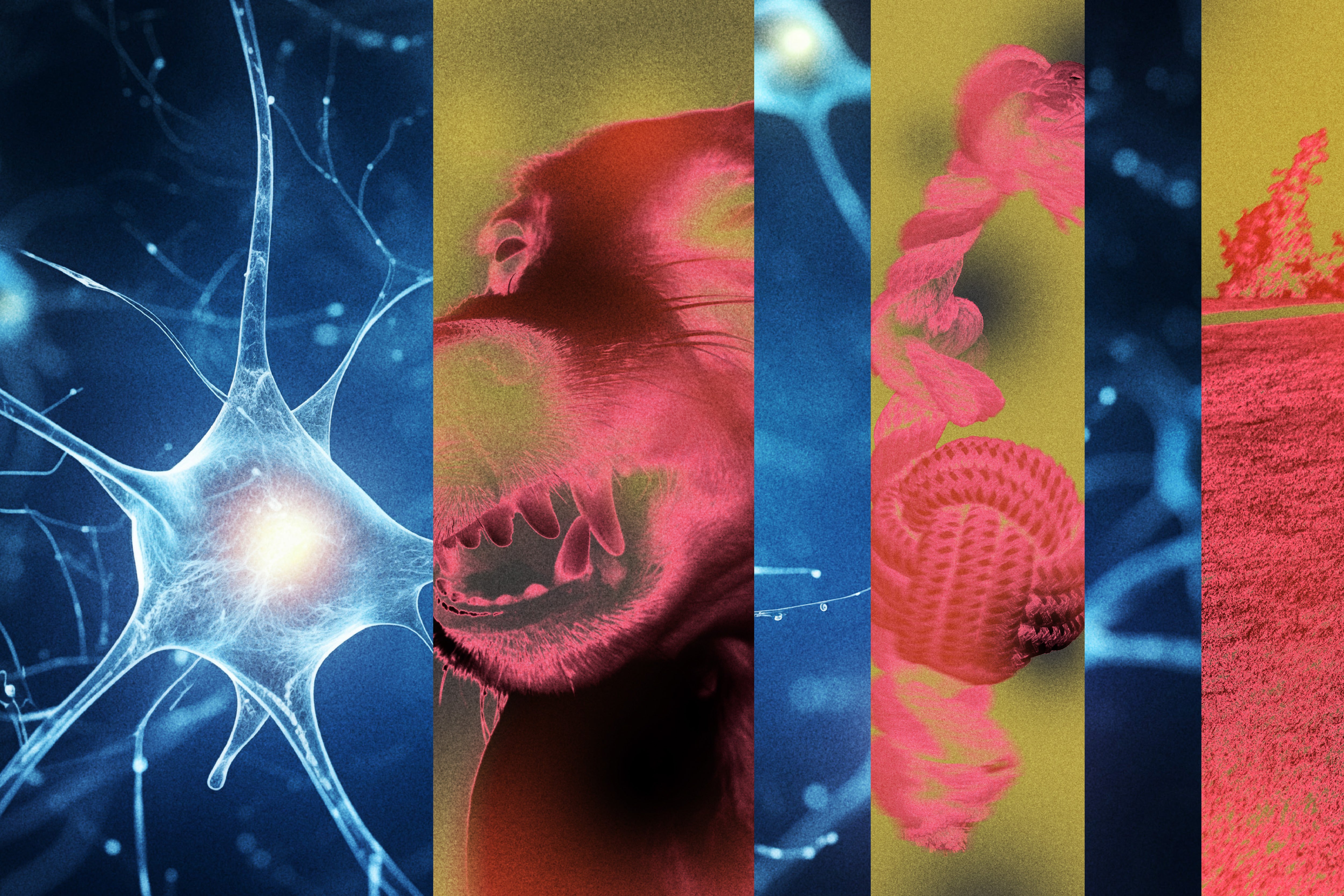Image of a neuron overlaid with images of a dog, a dog toy and a park
