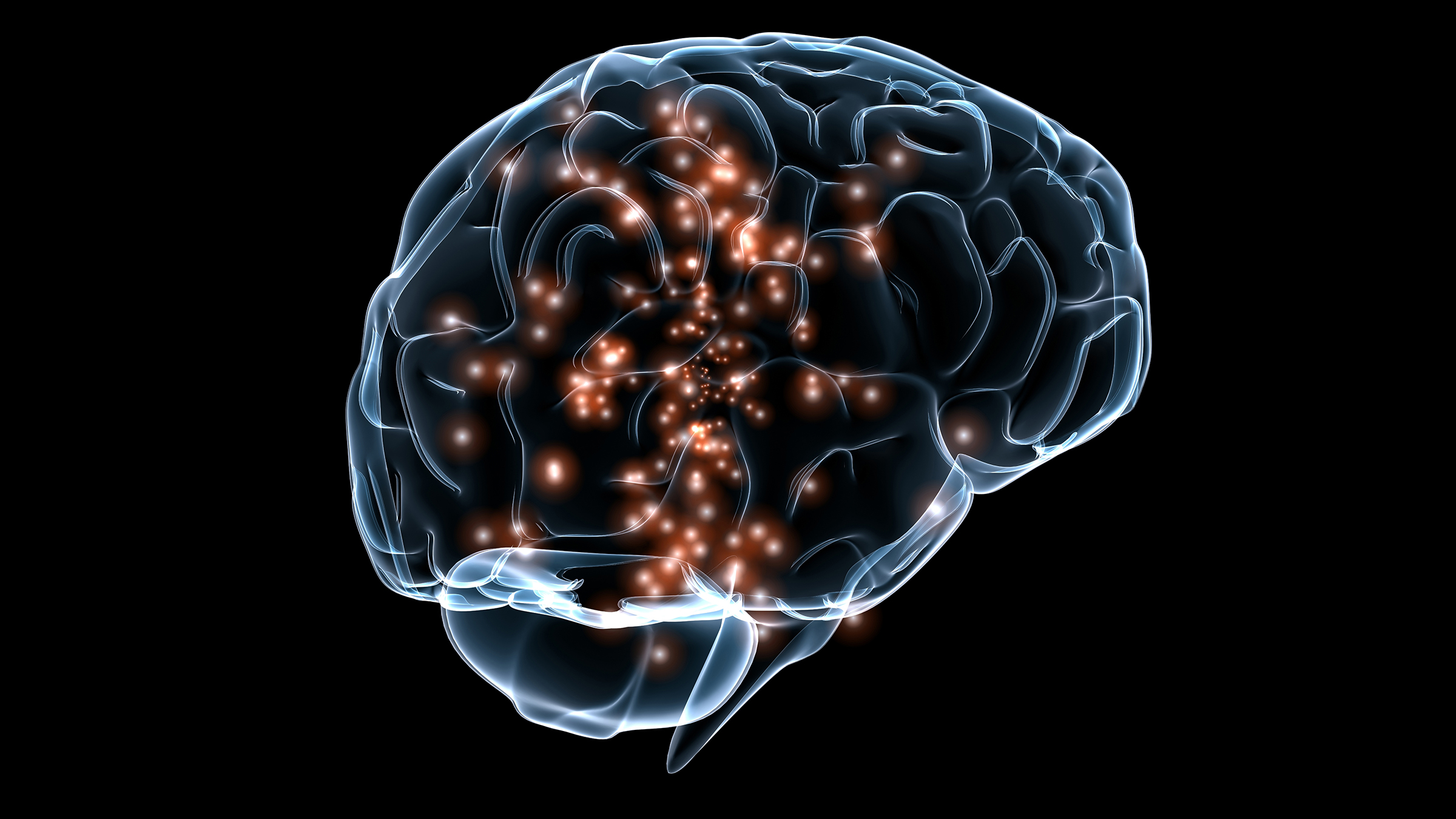 Illustration of a see-through brain with bright orange spots scattered in the interior