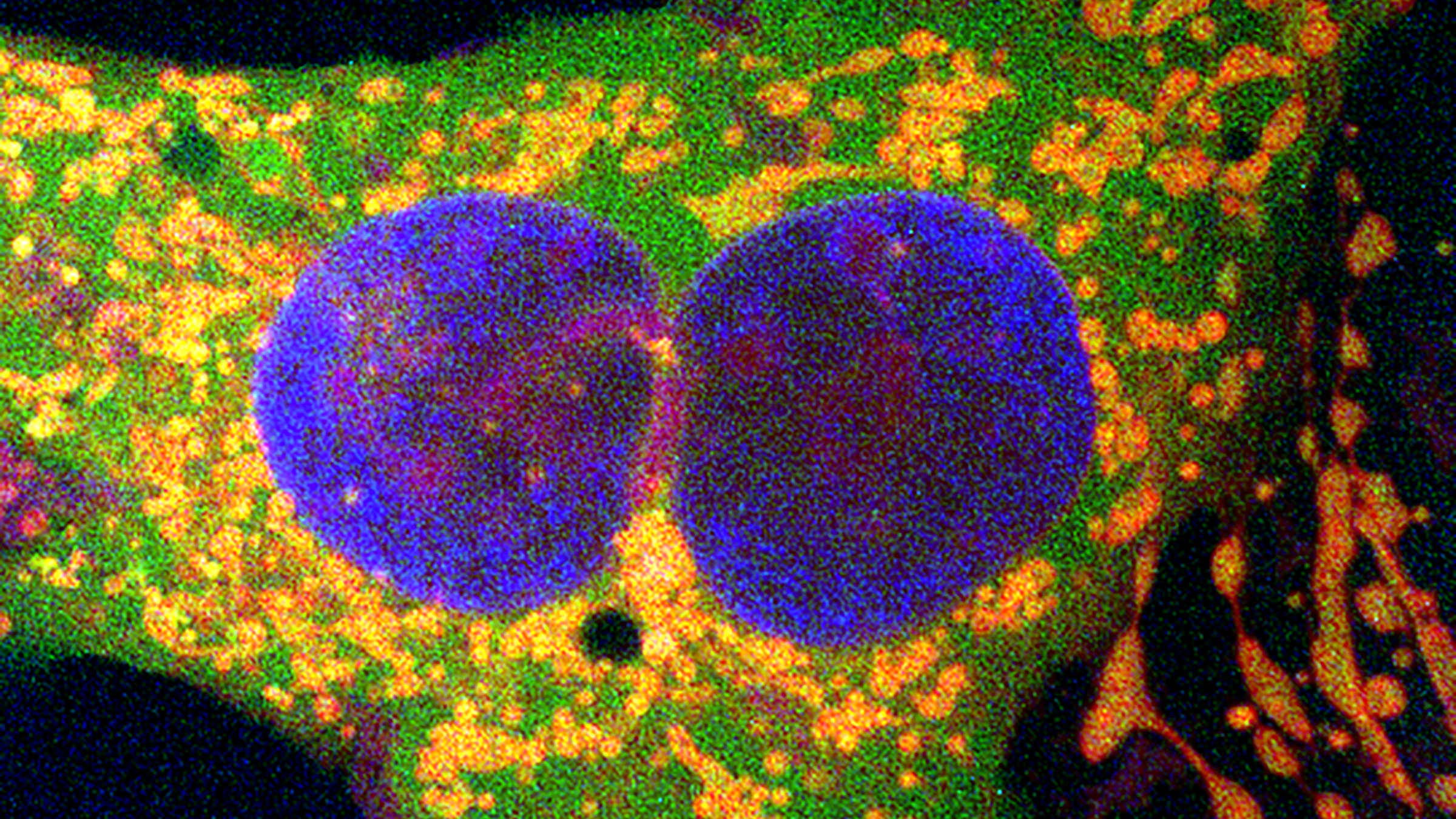 A microscope image shows human cells. There are two blue spheres in the center, surrounded by a green structure, with orange dots scattered around the green structure.