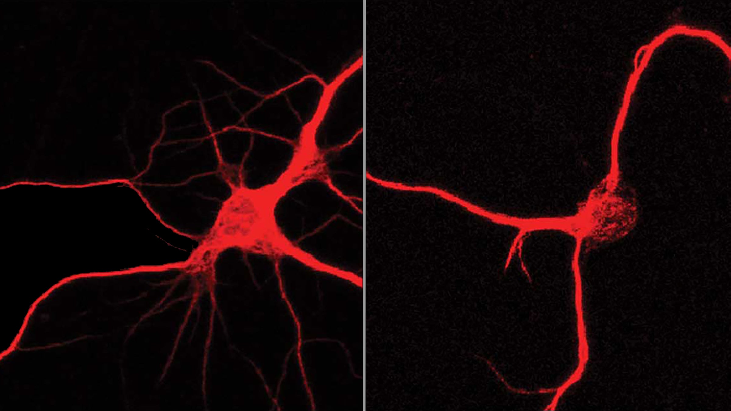 Two red neurons on a black background. The one one the left has many branches. The one on the left has few branches.